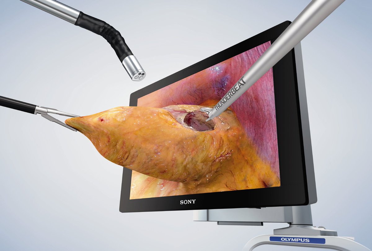 Olympus w Laparoskopii 3D w KCM Clinic