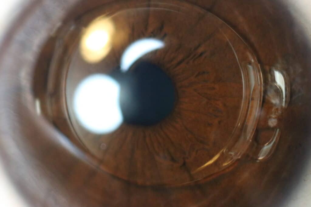 soczewki fakijne EVO Visian Implantable Collamer Lens