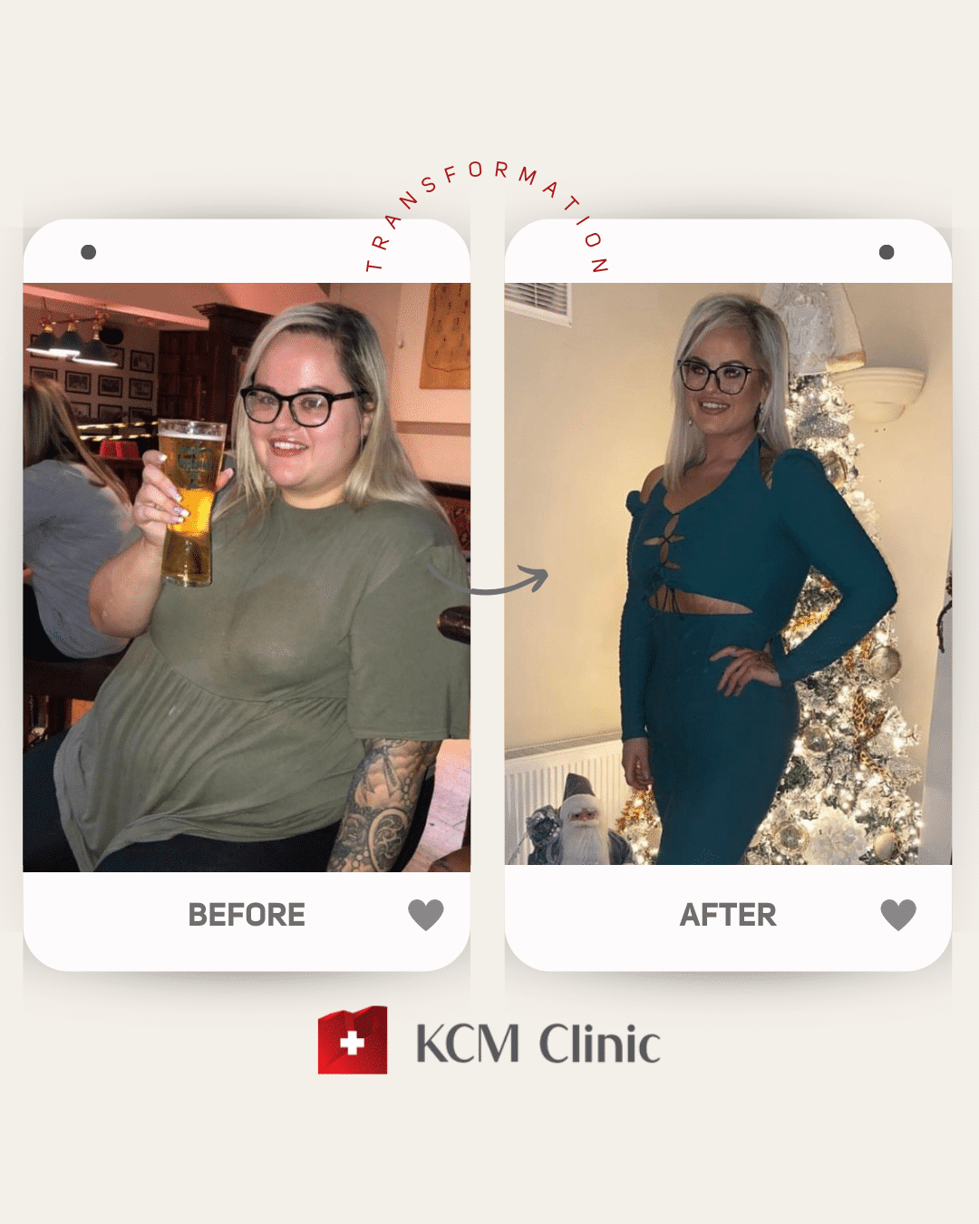 zmniejszenie żołądka bariatria otyłość weigh loss surgery