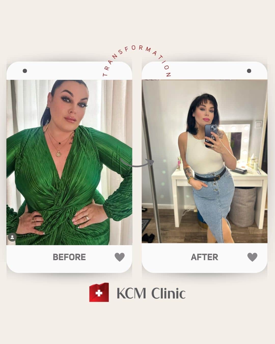 Bariatria otyłość zmniejszenie żołądka weight loss surgery