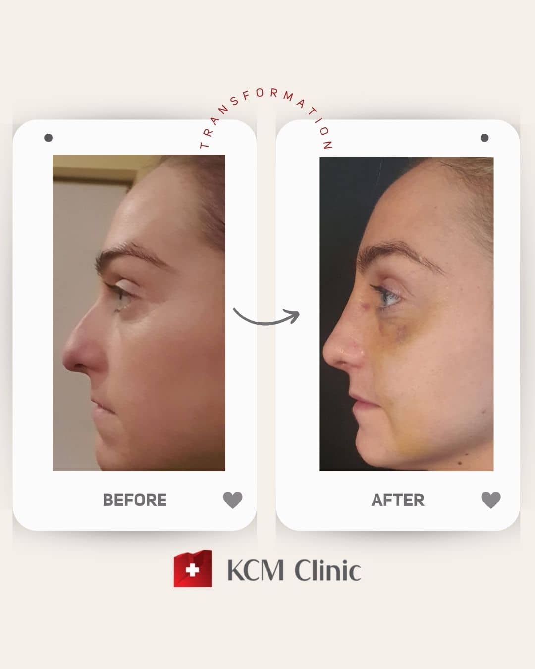 Plastyczna operacja Plastic surgery