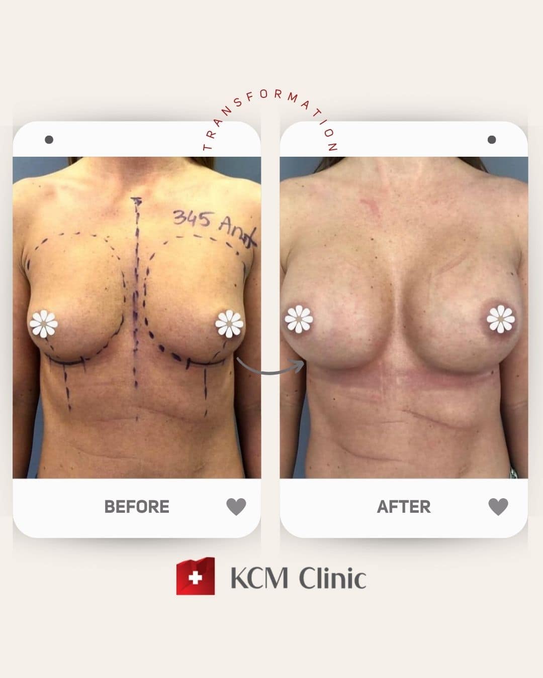 Plastyczna operacja Plastic Surgery