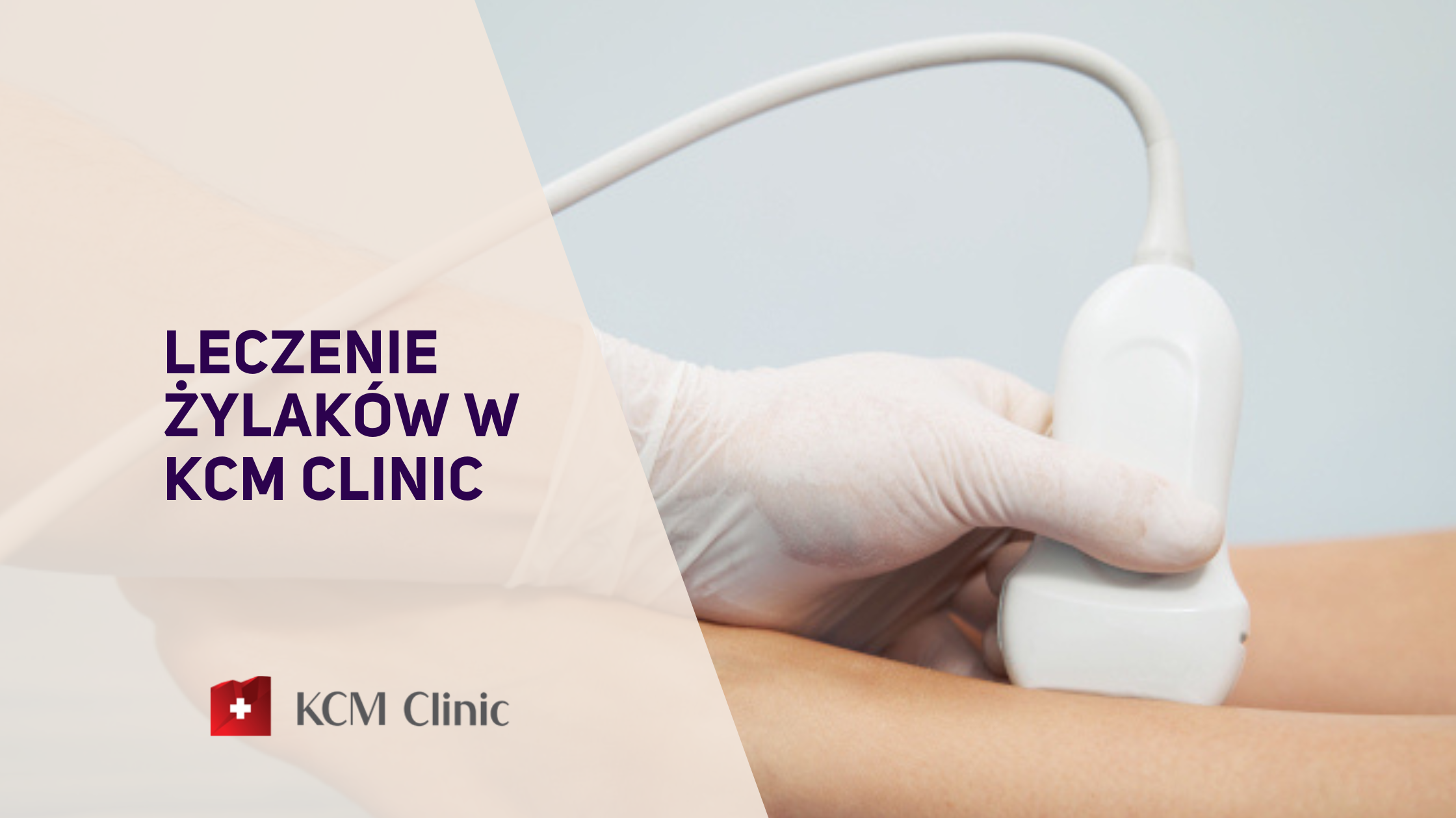 Żylaki kończyn dolnych - skuteczne zabiegi przywracające zdrowie i estetykę dostępne w KCM Clinic