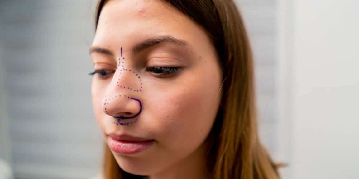 close-up plastic surgeon makes marks on a patient’s face during a consultation before nose operation